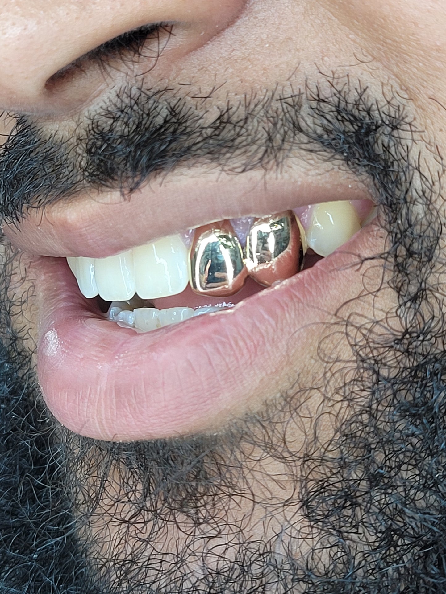 2 Teeth (Connected) Grillz #1 Solid