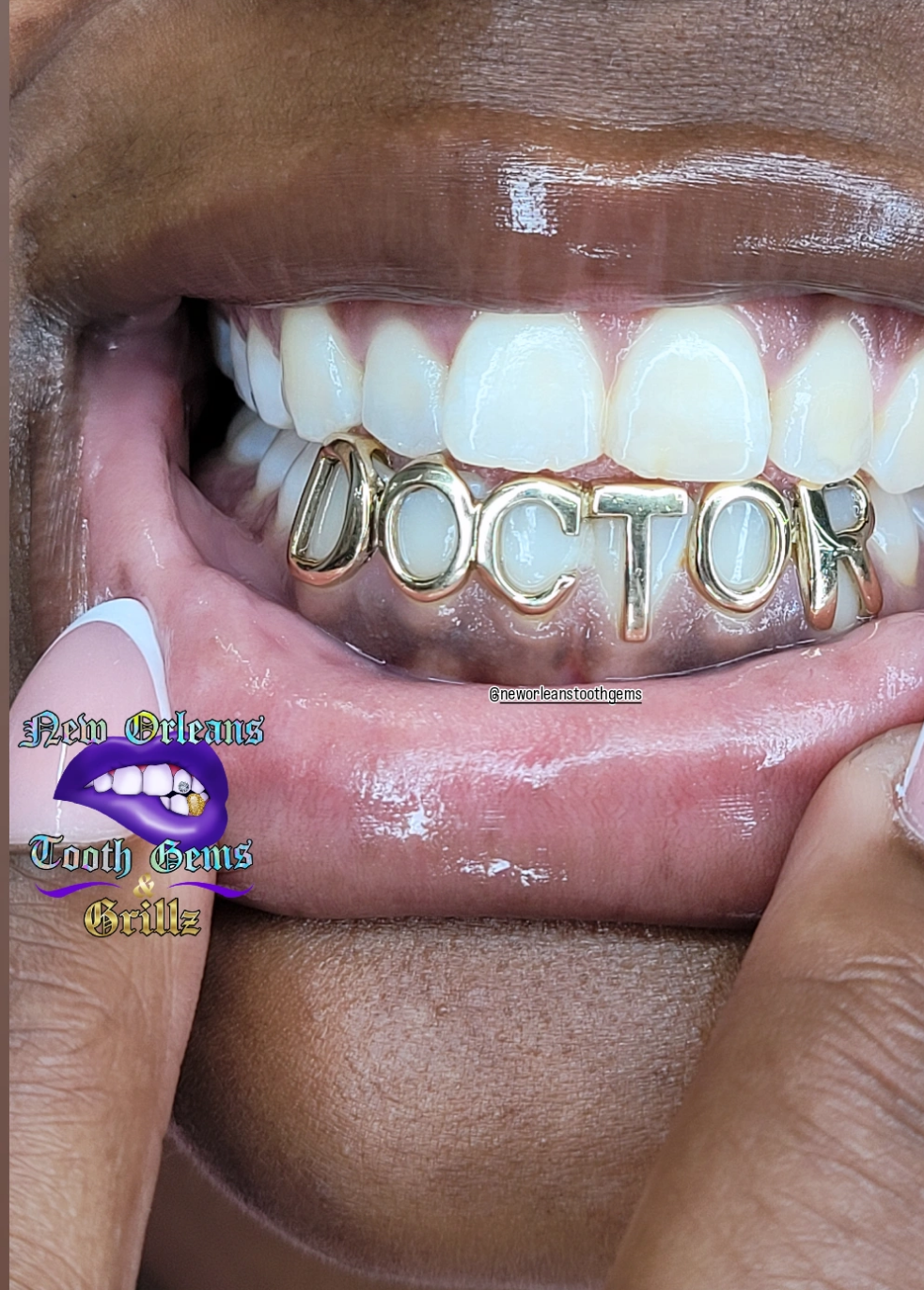 Letter Grillz (6 Teeth)