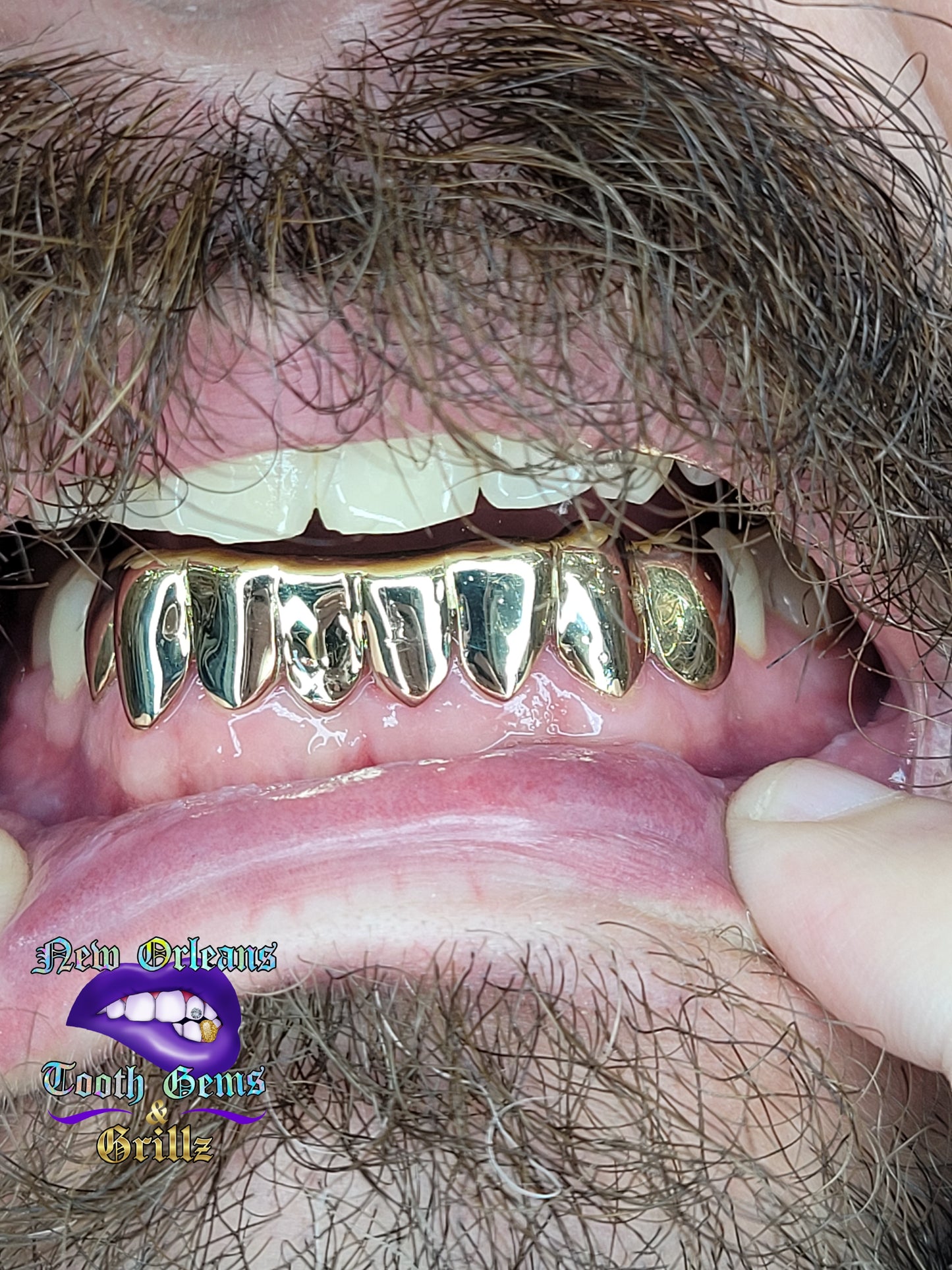 Solid 8 Piece Grillz (Connected)