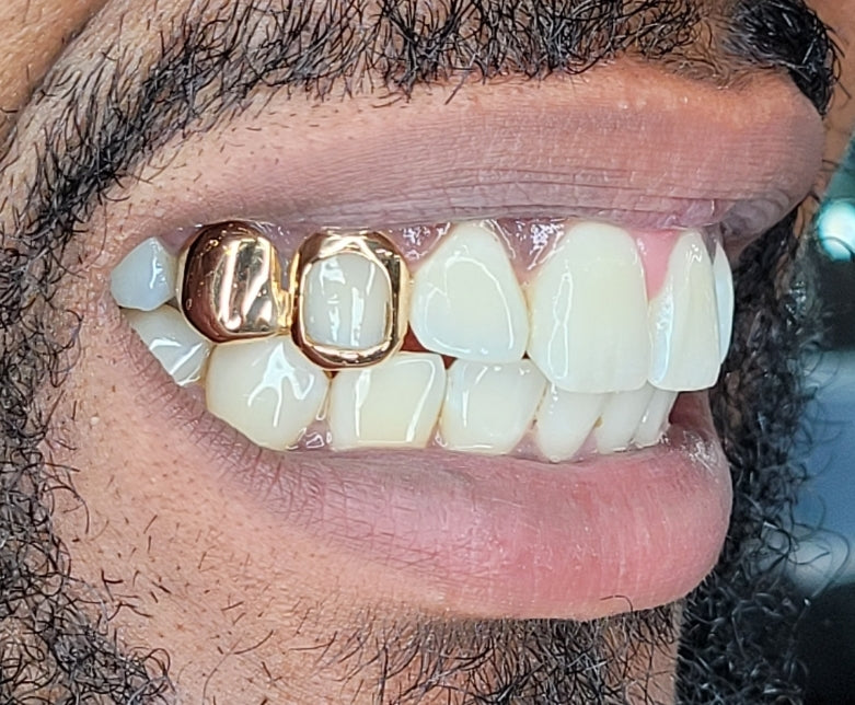 2 Teeth Grillz (Connected) #2 Solid/Open Face