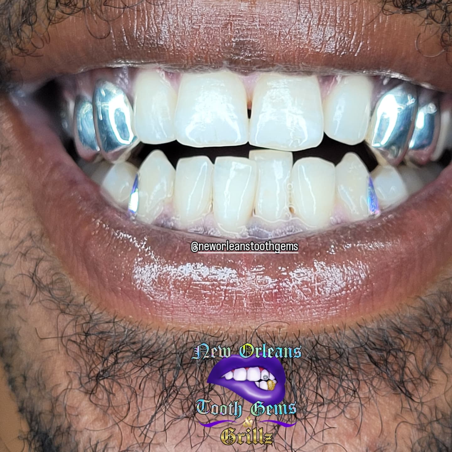 2 Side Pieces Set (Set of 2 connected Solid side pieces - 4 Teeth Total)