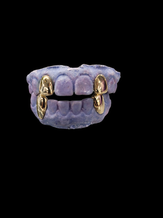 2 Top Solids 2 Bottom Solids (4 Teeth Total)