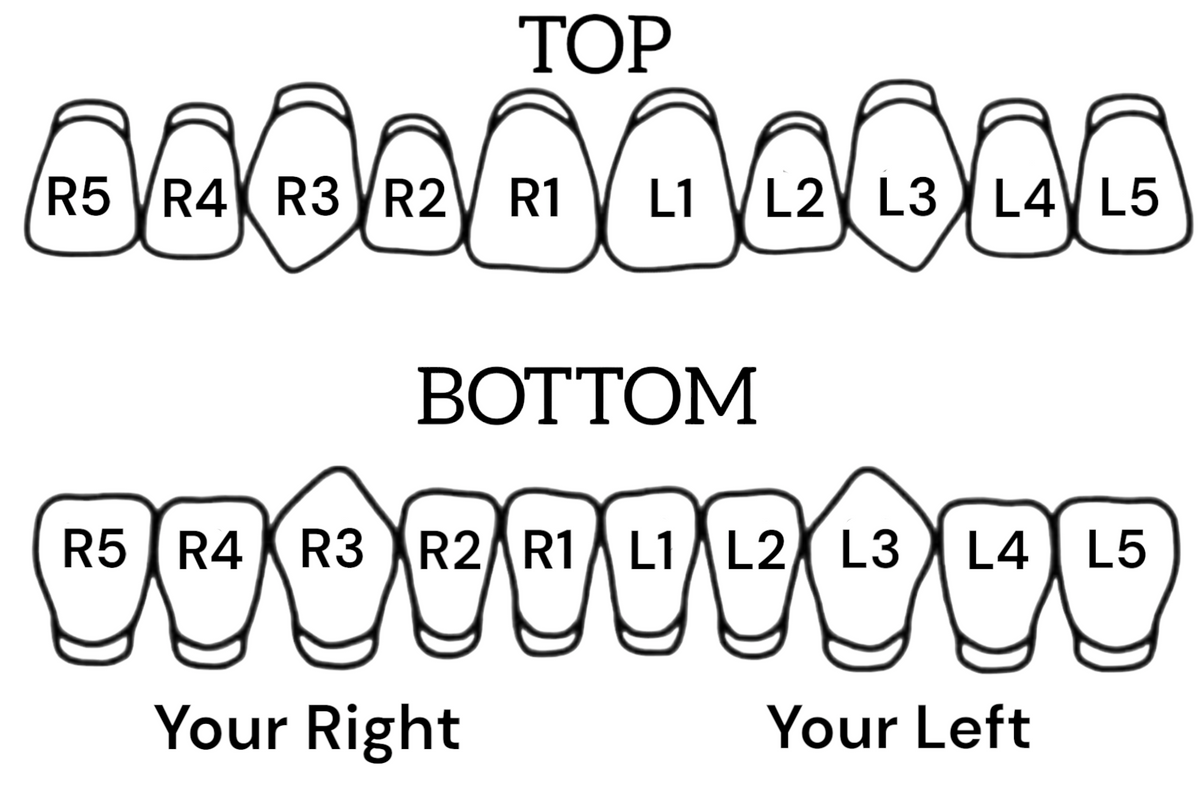 Teeth Grills Pattern Open Face Grillz (4 Teeth Connected) โ New Orleans Tooth Gems & Grillz