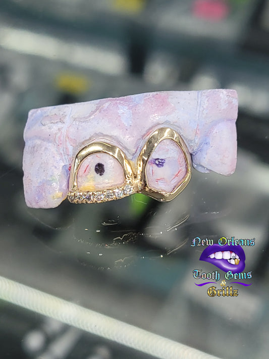 2 Teeth Grillz (Connected) - Classic Open Face/ Open Face with Moissanite Tip