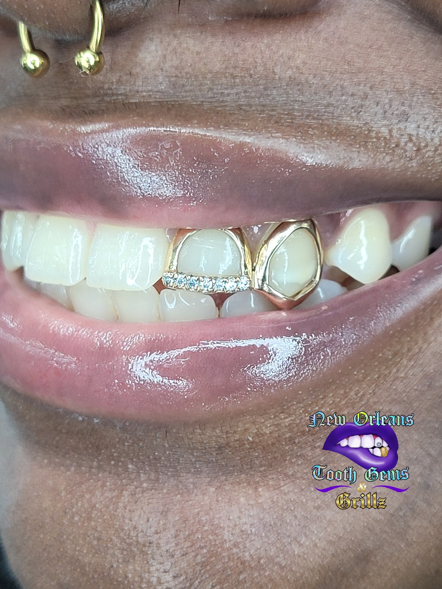 2 Teeth Grillz (Connected) - Classic Open Face/ Open Face with Moissanite Tip