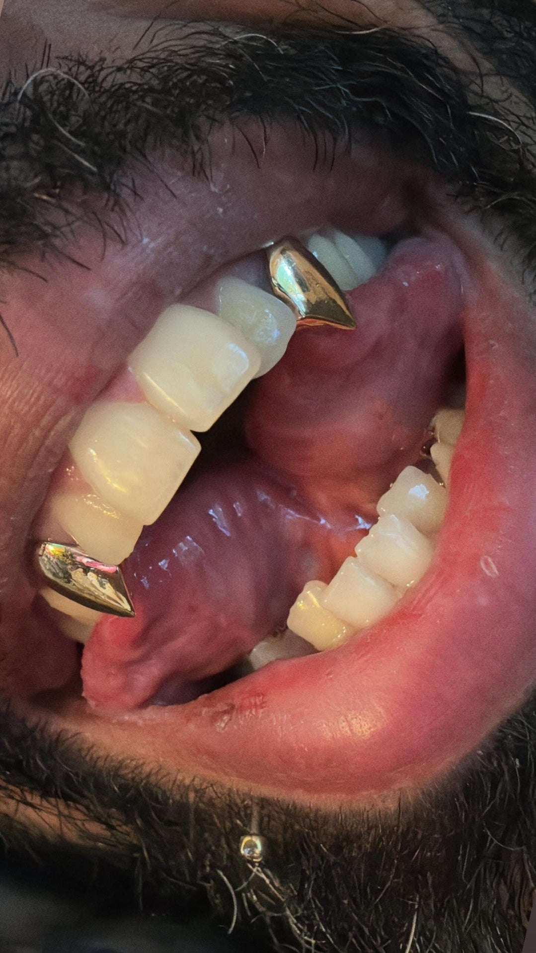 Extended Fangs (2 Teeth - Solid)